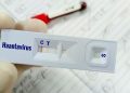 Warga Kulon Progo Suspect Virus Hanta Dinyatakan Tidak Terinfeksi