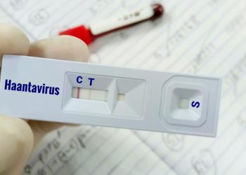 Warga Kulon Progo Suspect Virus Hanta Dinyatakan Tidak Terinfeksi