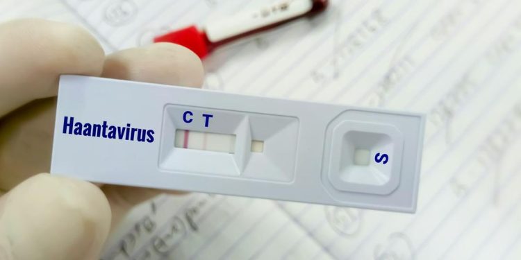 Warga Kulon Progo Suspect Virus Hanta Dinyatakan Tidak Terinfeksi